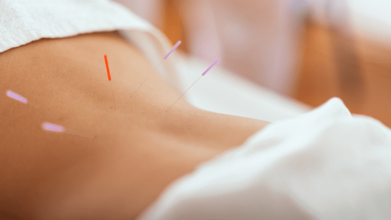 acupuncture sage femme mouchin