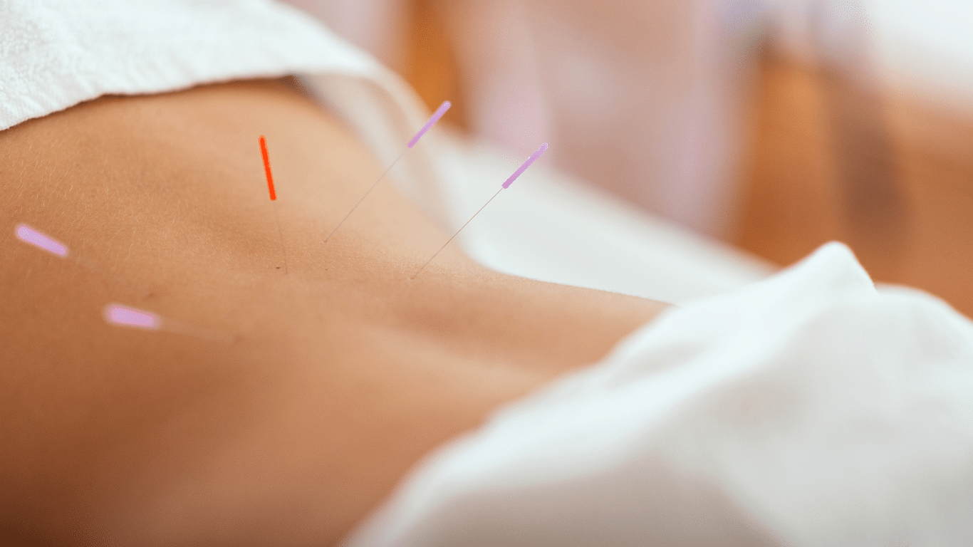 acupuncture sage femme mouchin
